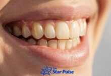 Brasssmile